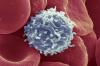 Para ilmuwan telah menemukan cara, menyebabkan sel-sel T untuk mulai melawan kanker