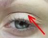 Bagaimana menyingkirkan kelopak mata terkulai tanpa plastik