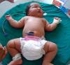 6 hingga 8 kg: bayi baru lahir terbesar di dunia