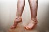 Pelanggaran aliran darah di kaki: Penyebab, Gejala