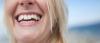Gigi alami whitening. Apa yang Anda butuhkan?