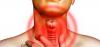 Apakah tiroid Anda sehat? Cara cepat untuk belajar