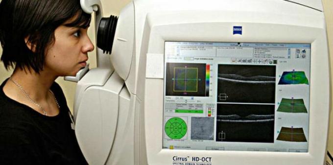 tomografi koherensi optik angiografi