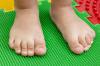 Bentuk kaki datar yang "baik" dan "jahat" pada anak-anak