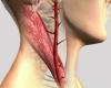 Penyumbatan arteri karotis: 8 tanda-tanda yang benar