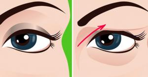 Bagaimana untuk mengangkat kelopak mata tanpa operasi? Tidak ada make-up, rahasia sangat berbeda!