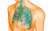 Penyakit paru-paru yang merayap tanpa diketahui