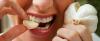 7 cara bagaimana untuk menyingkirkan bau mulut bawang putih
