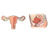 Apa yang terjadi pada rahim sebelum dan sesudah melahirkan: apa yang perlu survei