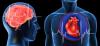 Serangan jantung dan stroke: 7 kesalahan utama yang mereka memprovokasi