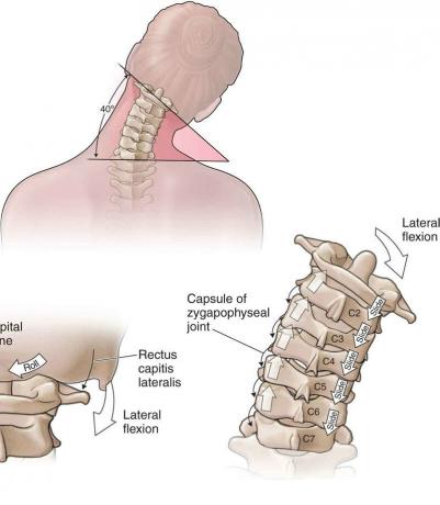 4 latihan dasar untuk tulang belakang leher akan membantu Anda melupakan rasa sakit dan osteochondrosis!