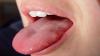 7 alasan utama lidah nyeri