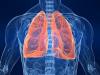 Perokok: bagaimana untuk membersihkan bronkus, paru-paru?